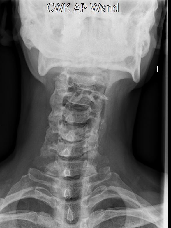 iQ-LITE_2015-01-05_18-28-49.jpg